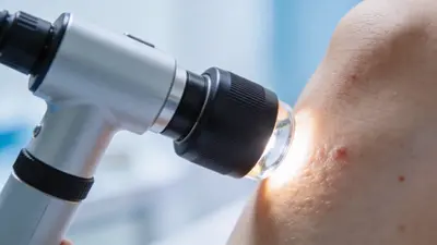 Dermatológ na Slovensku: čakacie doby, ceny a kedy ísť radšej inde?